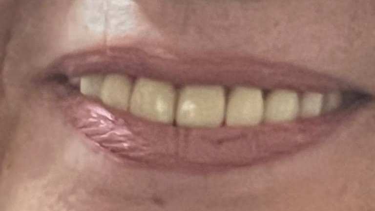 Neşe Yaşın:RUJUN VAR MI?